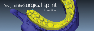 Desing of the Splint