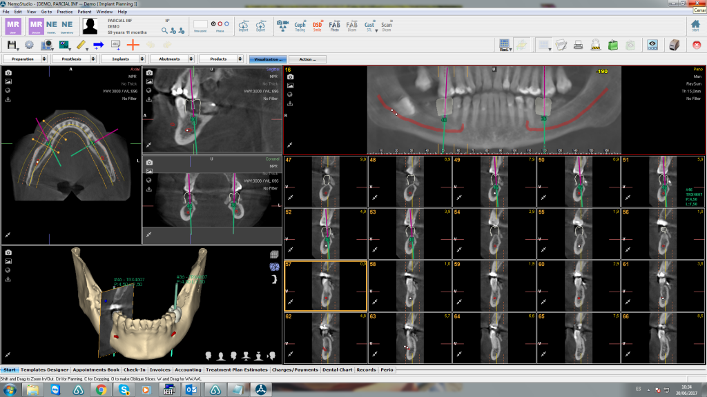 NemoScan 3