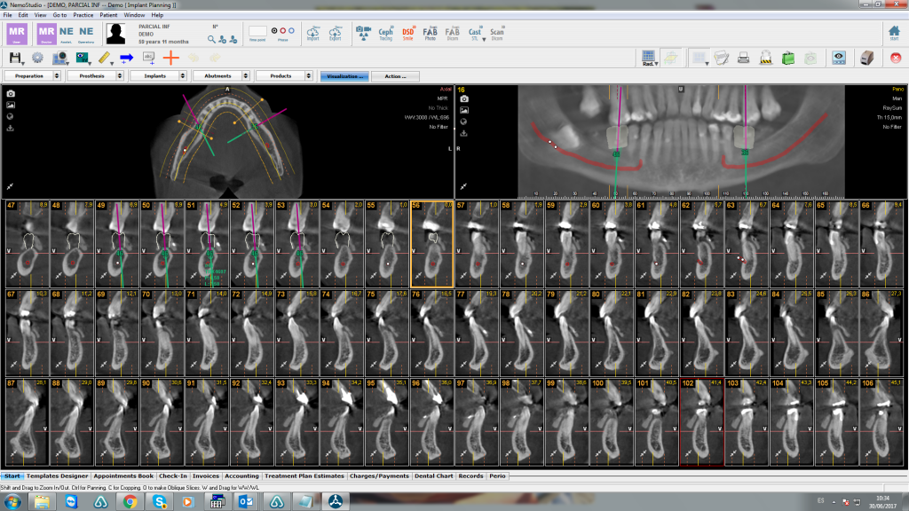 NemoScan 4