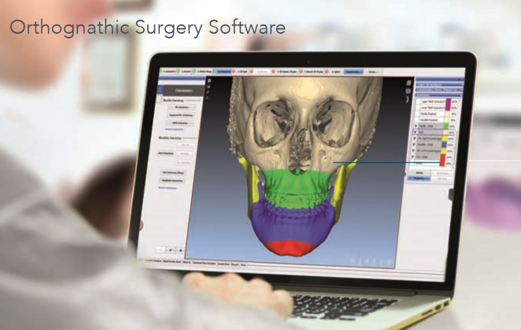 Orthognatic Surgery Software