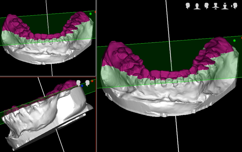 Webinar DICOM2