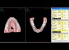 Planificación 3D con NemoCast