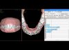 Planificación 3D con NemoCast