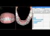 Planificación 3D con NemoCast