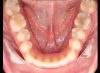 Foto de Oclusal