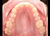 Foto de Oclusal
