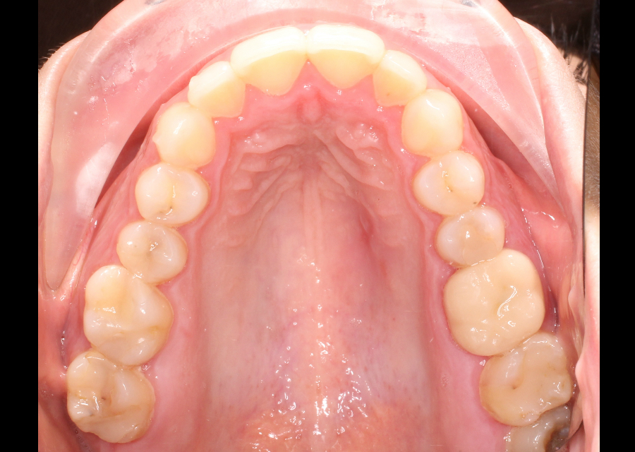 Foto de Oclusal