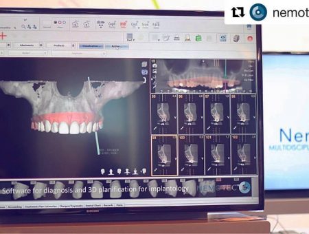 Webinar NemoScan 2