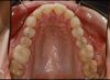 Foto de Oclusal