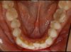 Foto de Oclusal
