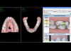 Planificación 3D con NemoCast