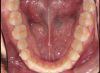 Foto de Oclusal