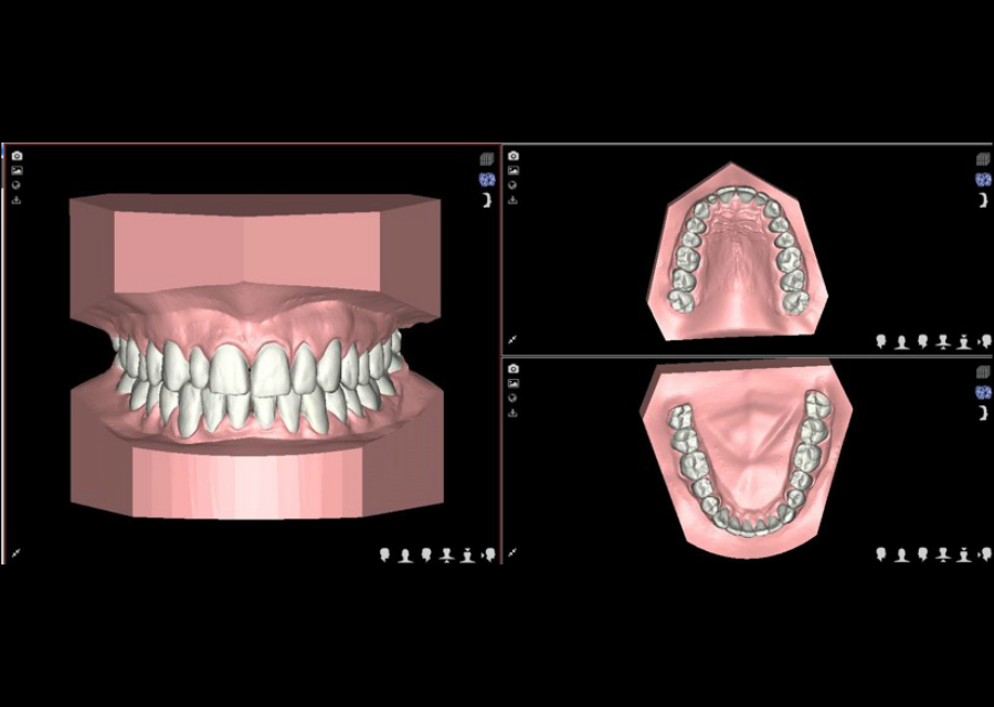 Planificación 3D con NemoCast