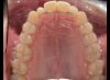 Foto de Oclusal