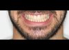 Foto de Sonrisa