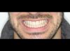 Foto de Sonrisa