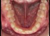 Foto de Oclusal