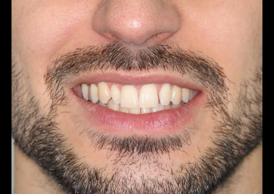 Foto de Sonrisa