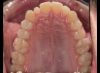 Foto de Oclusal