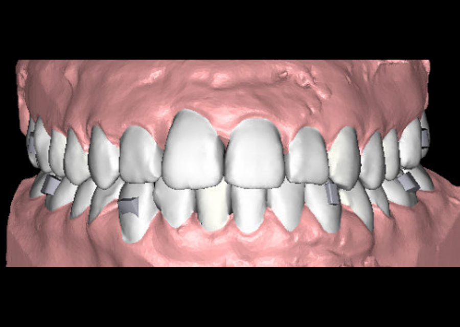 3D Model
