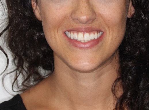 Smile Photo