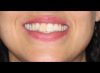 Smile Photo