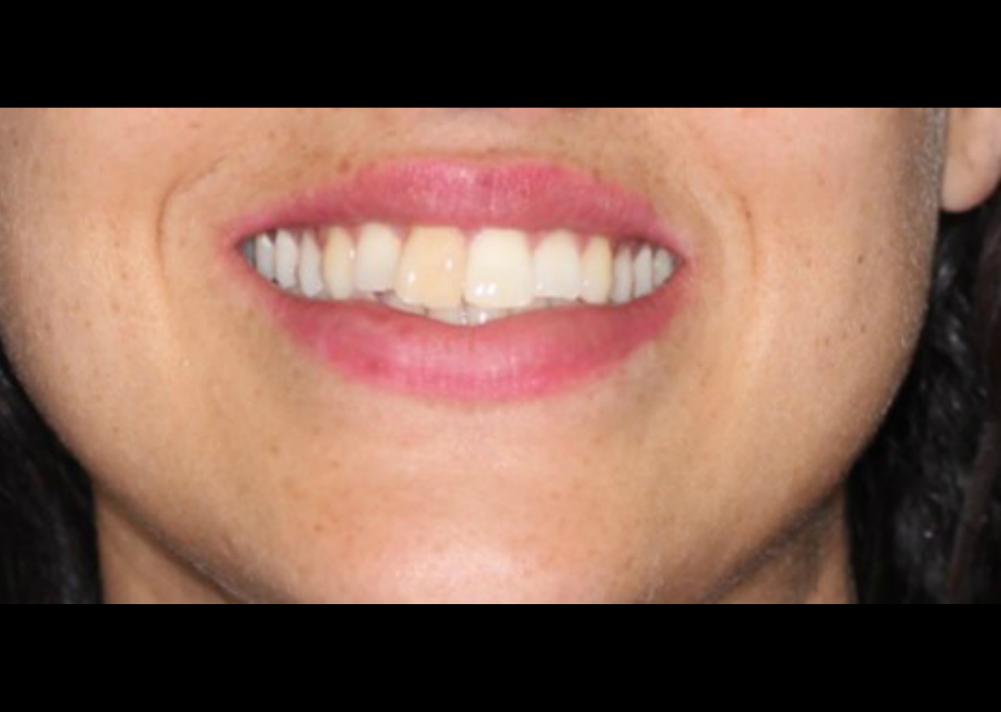 Smile Photo