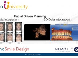 1. NemoSmile Design. Digital Records Protocol by Dr. Javier Vasquez