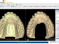 2. Importing Additional Meshes (STL)