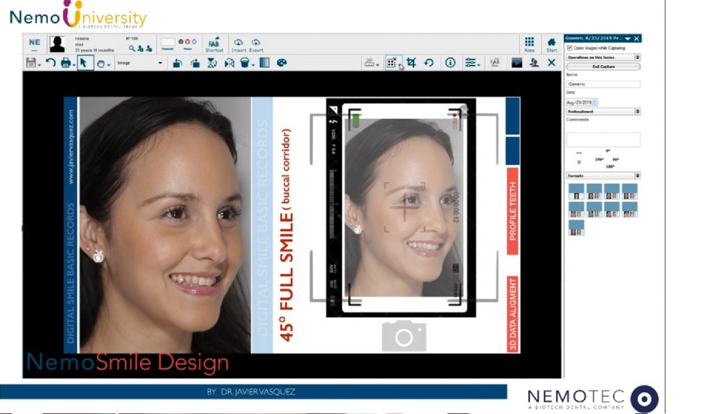 2. NemoSmile Design. Create a New Patient