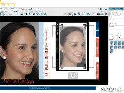 2. NemoSmile Design. Create a New Patient