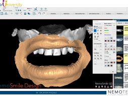 3. Mesh Edition Tools