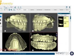 Core Video. NemoSmile Design by Dr. Javier Vasquez