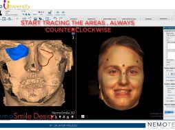 6. Alignment of Face Scan