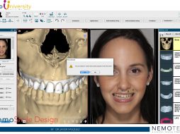 Core Videos. NemoSmile Design. Alignment pictures and meshes