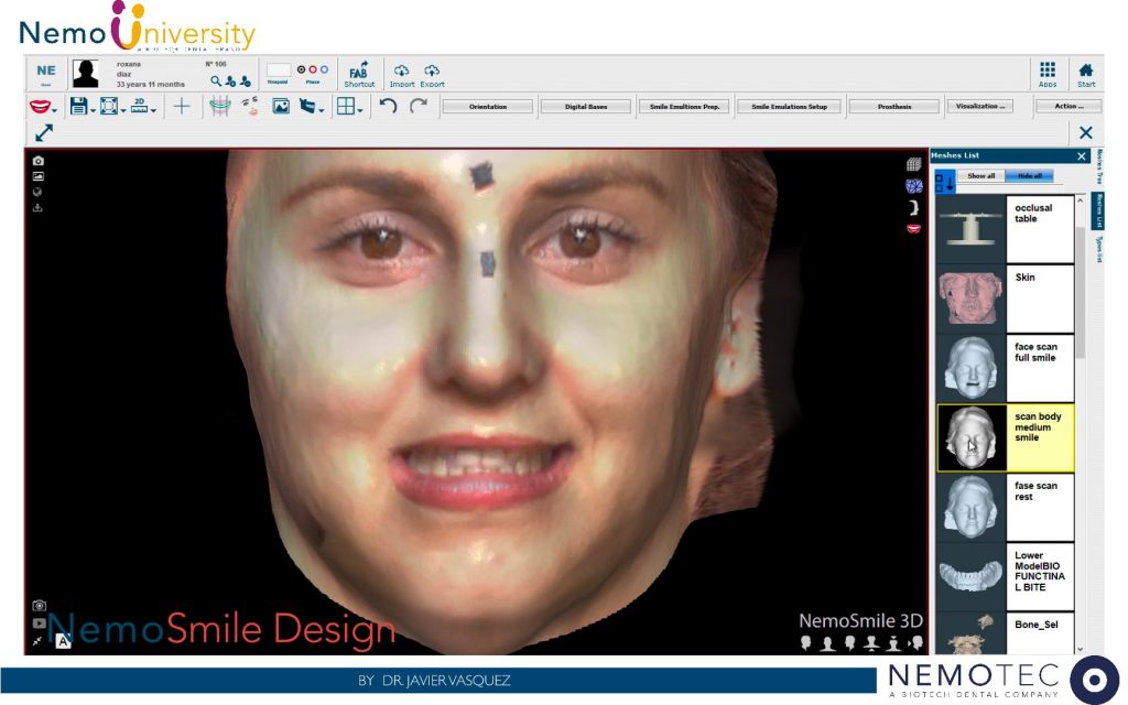 8. NemoSmile Design. FaceScans