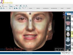 8. NemoSmile Design. FaceScans