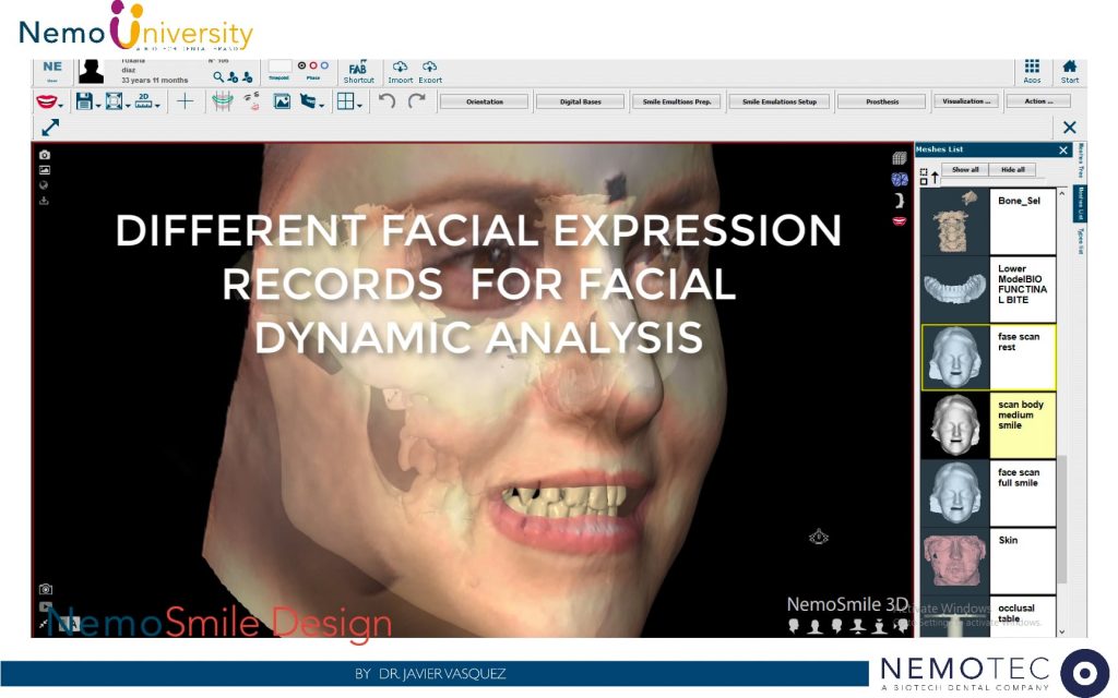 9. NemoSmile Design. Prosthetic Planning