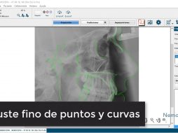 Ajuste fino de puntos y curvas