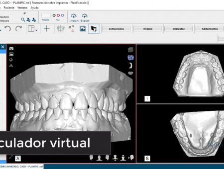 Articulador Virtual