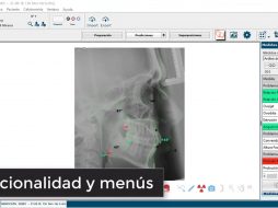 Funcionalidad y menús