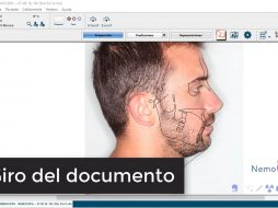Giro de la foto