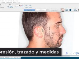 Impresión, trazado y medidas