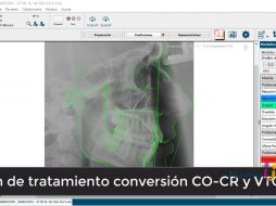 Plan de tratamiento conversión CO-CR-VTO