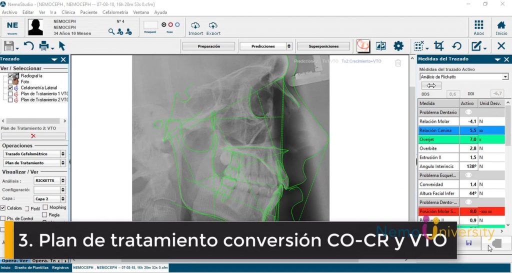 Plan de tratamiento conversión CO-CR-VTO