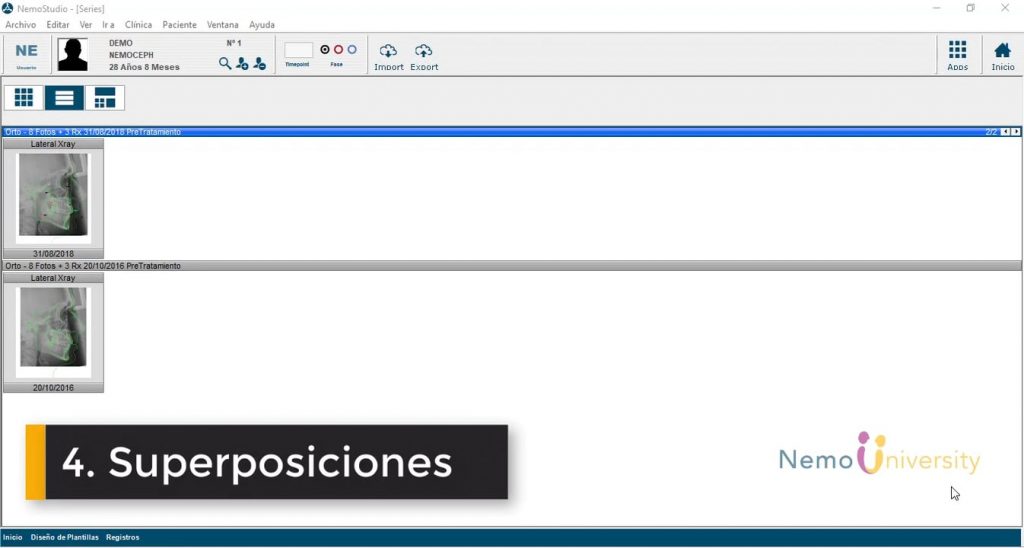Superposiciones