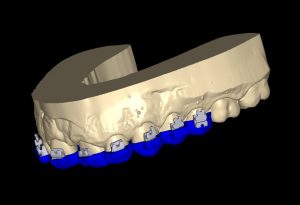 cemetado ortho 4