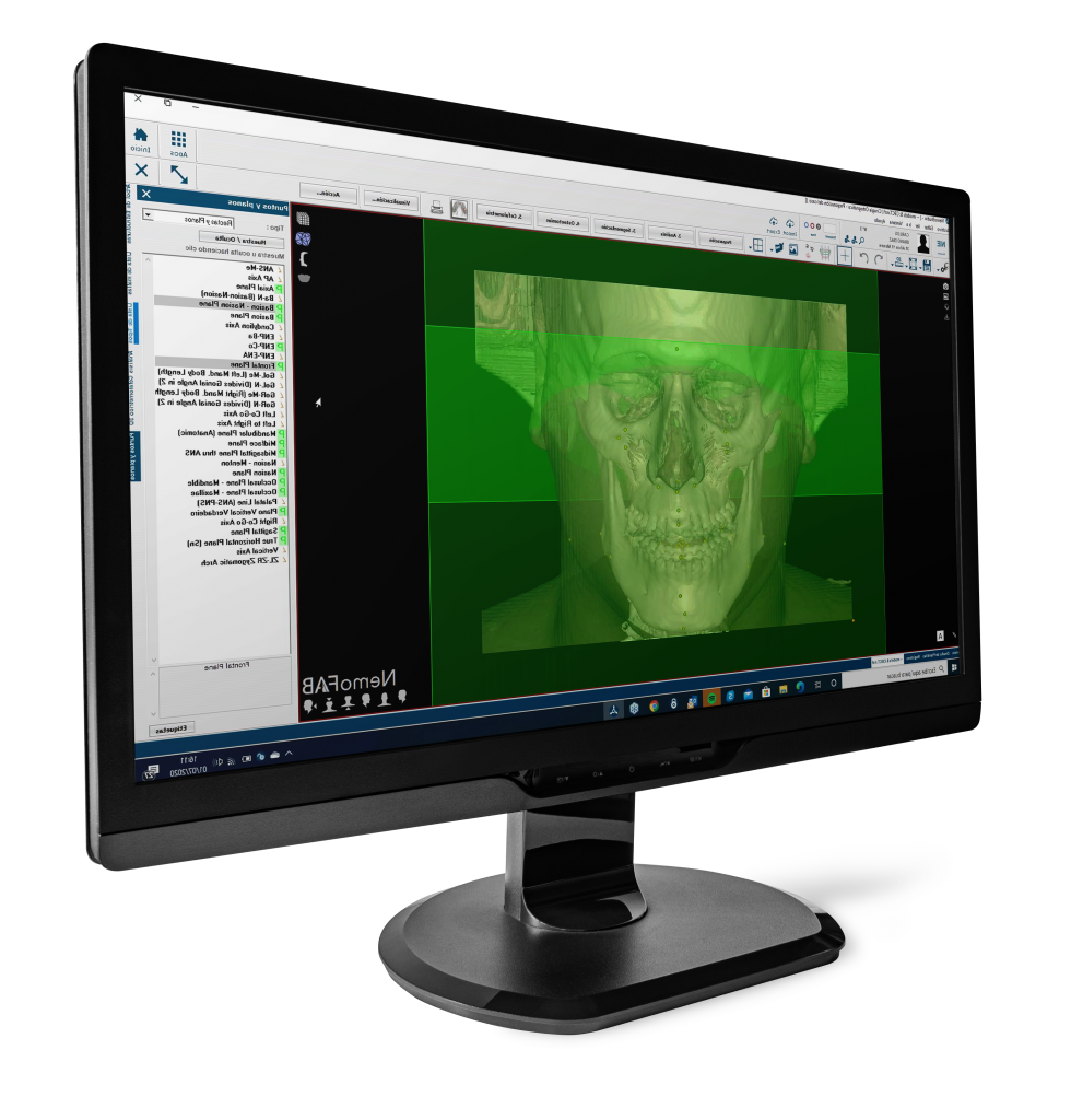 MONITOR NEMOFAB ORTHO