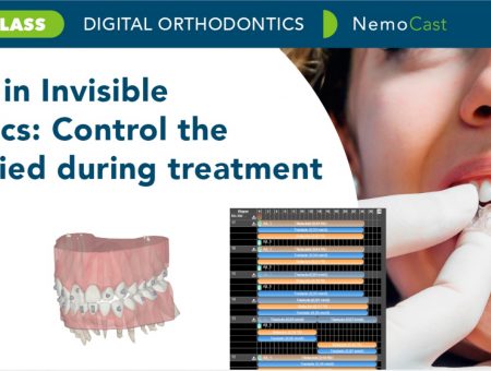 Key points in Invisible Orthodontics