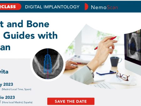 Sinus lift